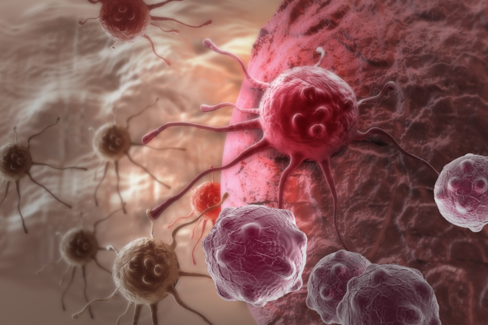 Let Us Know Type of Cancer